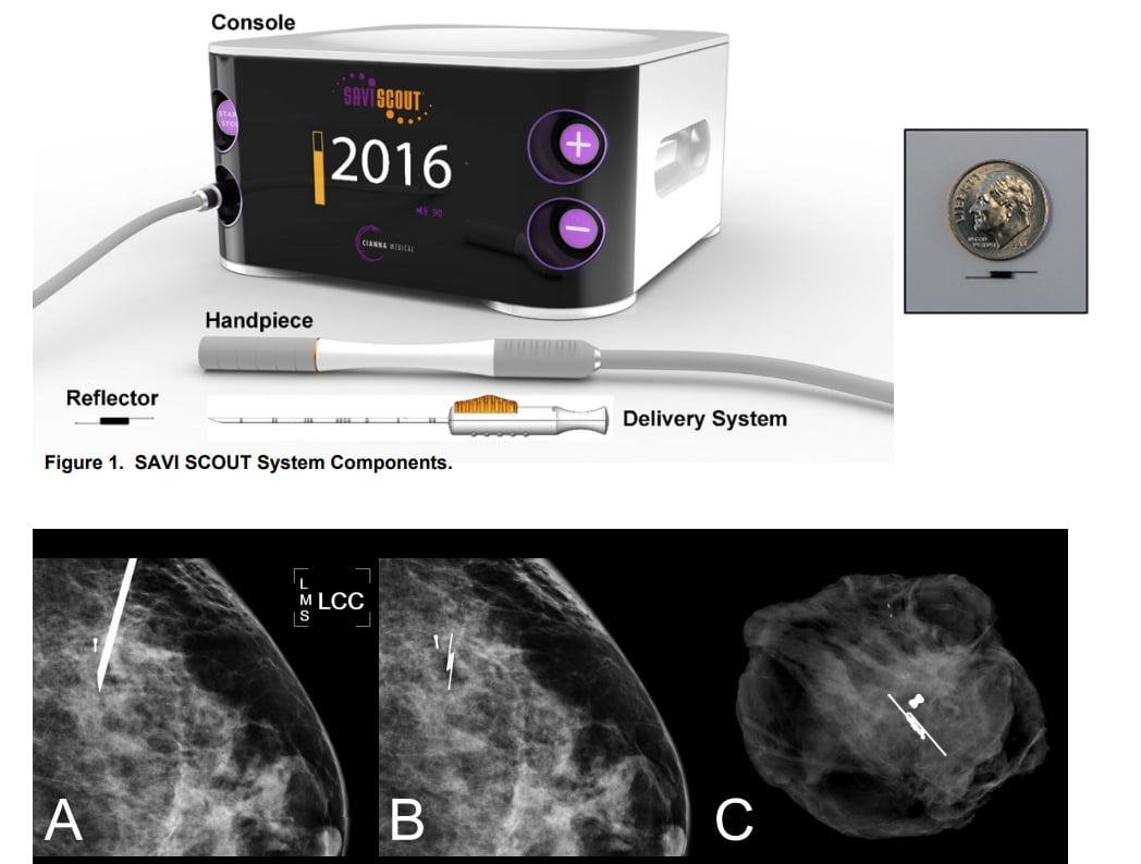 Cianna Medical Savi Scout雷达定位系统，显示控制台、探测器和标记，以及乳房组织内部的大小比较和x射线图像。有关其使用的学习曲线的更多信息http://sabcs16.posterview.com/nosl/p/P1-11-06。