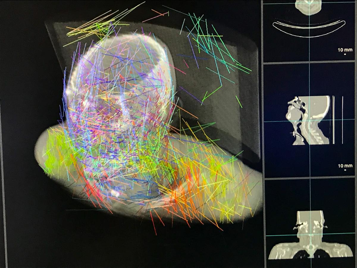 Pymedix AI图像自动注册多个CT检查，治疗计划和轮廓到一个数据集。# ASTRO # ASTRO2021 # ASTRO21