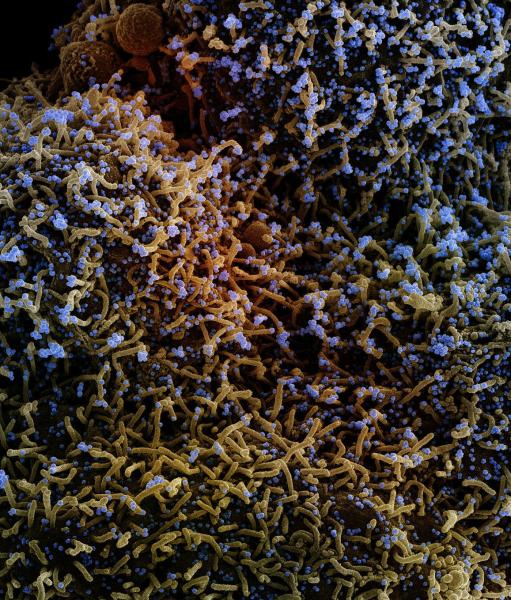 从患者样本中分离出的感染SARS-CoV-2病毒颗粒变异株(蓝色)的细胞的彩色扫描电子显微照片。NIAID