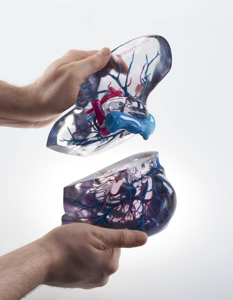3D打印的心脏和冠状动脉树从患者的CT扫描。