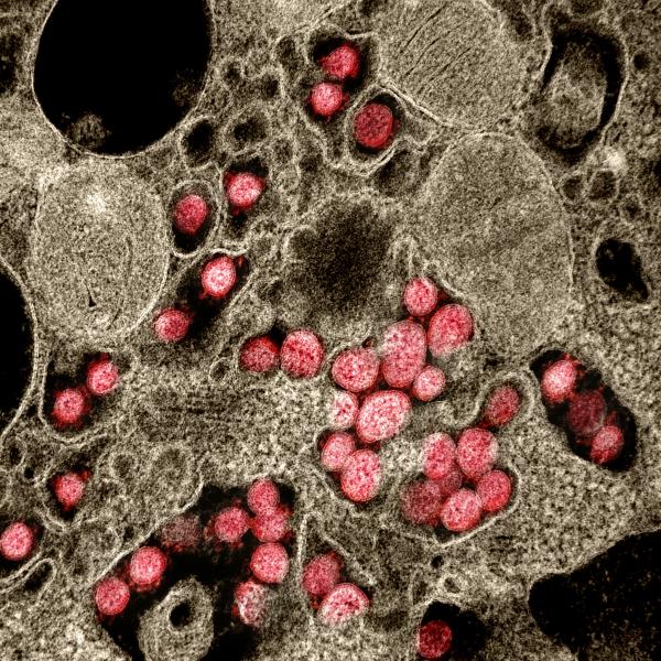 美国国立卫生研究院(NIH)拍摄的附着在宿主细胞上的冠状病毒(COVID-19)图像。