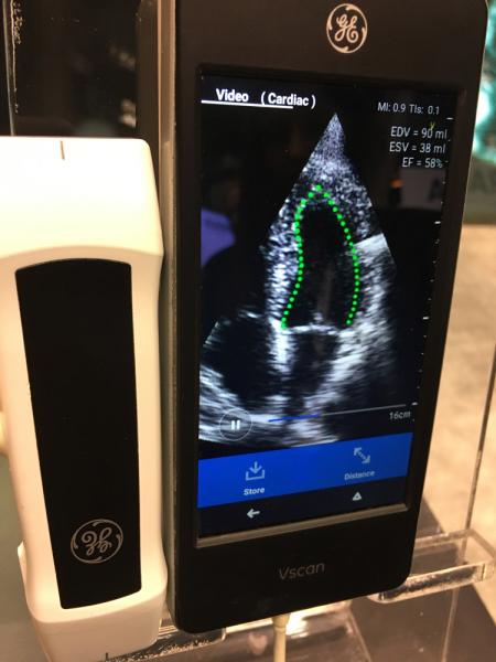 这是LVivo自动弹射分数应用程序，使用了来自Dia的人工智能(AI)。用户在几秒钟内打开应用程序，AI定义心肌边界并计算左心室的EF。这里显示的是它集成到GE医疗VScan点护理超声系统(POCUS)中。该公司还与科尼卡美能达(Konica-Minolta)合作，为其心脏PACS提供汽车EF。# RSNA # RSNA19