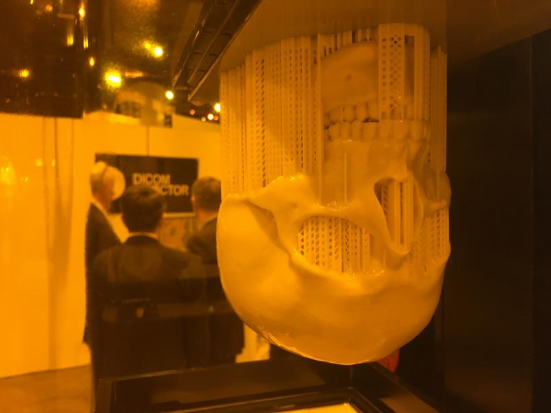 3d打印头骨仍在打印机中，由CT扫描在2019年RSNA的昂科威TEC展台创建。