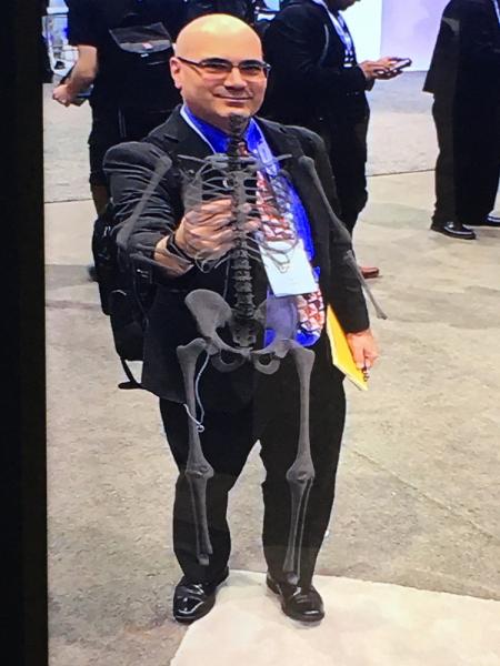 ITN编辑Dave Fornell报道。通用电气医疗保健公司展示的软件，展示了增强现实如何用于患者教育。它将一个完整的骨骼叠加在一个大显示屏上，当病人移动时，骨骼也会跟着移动。