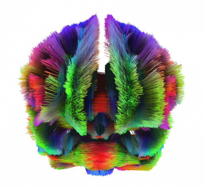 弥散束摄影可以让我们观察到大脑中的白质，白质是大脑不同区域之间的交流通道。