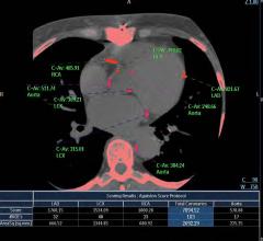北美放射学会(RSNA)报道冠状动脉钙(CAC)评分使用非造影剂心电门控计算机断层扫描(CT)是一种快速、廉价和可重复的检查，可有效预测心血管疾病发展的风险，并指导无症状个体的预防治疗