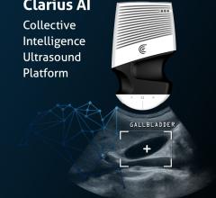 Clarius移动健康宣布Clarius AI集体智慧超声平台