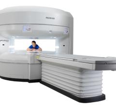 在芝加哥举行的2021年北美放射学会(RSNA)会议上，诊断成像和医学信息学解决方案提供商富士医疗保健美洲公司发布了其先进的高场开放MRI系统Velocity MRI System。