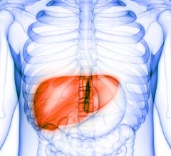 原发性肝癌在世界范围内呈上升趋势，主要是由于丙型肝炎感染和慢性肝病的增加