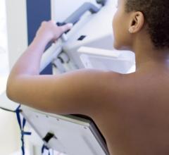 西奈山卫生系统推出了“乳房x光检查五月”计划，通过安排每年一次的乳房x光检查，使女性能够负责自己的乳房健康。