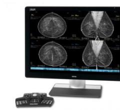 合作将包括数据共享、研发和将RadNet系列乳房x线摄影系统升级为Hologic最先进的成像技术