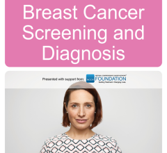 美国国家综合癌症网络(机构)发布了新发现患者指南:乳腺癌筛查和诊断,帮助人们理解他们的个人乳腺癌的风险,当他们应该开始筛选和多久的屏幕