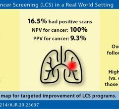 “我们的研究表明，在重要的性能指标方面，现实世界的肺癌筛查可以与随机对照试验类似，”这篇AJR文章的作者总结道。图片由美国x射线学杂志(AJR)提供