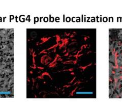 发光氧探针PtG4在放射治疗的一周内注射，并在显微镜下显示在肿瘤细胞之间