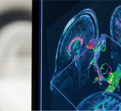 布里格姆妇女医院7T核磁共振成像系统的图像