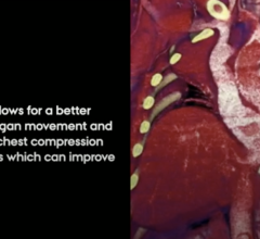 作为一项国际合作的一部分，奥胡斯大学和莱斯特大学的研究人员成功开发了一种动态三维CT扫描方法，可以显示模拟心脏按摩时体内发生的情况