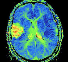 总部位于底特律的磁共振成像(MRI)技术公司SpinTech, Inc.收购了医疗成像研究和技术开发商磁共振创新公司(MR Innovations)。