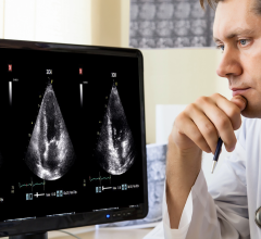 美国西奈山伊坎医学院(Mount Sinai's Icahn School of Medicine)的心脏内科医生团队最近在美国心脏协会(American Heart Association)会议上发表了一项研究，介绍了一家领先的基于人工智能的超声分析软件提供商DiA Imaging Analysis。