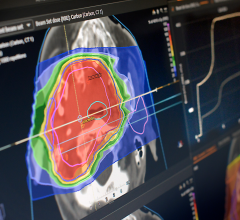 GE医疗集团(GE Healthcare)自豪地宣布，该公司已与领先的放射肿瘤学软件提供商RaySearch Laboratories AB达成合作协议，开发一种新的放射治疗模拟和治疗计划工作流程解决方案，旨在简化靶向放疗缩小肿瘤的方式。