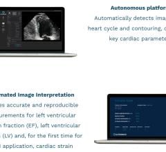 EchoGo使用人工智能(AI)计算心脏超声左心室射血分数(EF)，这是最常用的心脏功能测量方法，左心室容积(LV)，并首次用于人工智能应用，自动心脏应变。
