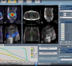 FDA批准核磁共振引导放射治疗系统