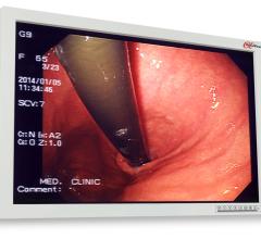 AlphaView推出24英寸手术显示器