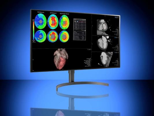 双黑成像(DBI)宣布，LG电子将立即推出两款以放射学为重点的医疗级显示器，并与DBI的综合校准软件包捆绑在一起。