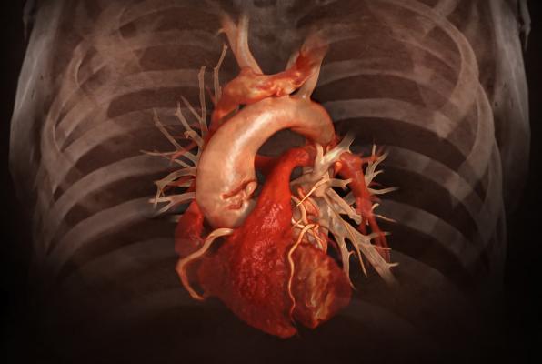 新的Aquilion One Genesis SP心脏CT系统使用人工智能帮助重建低剂量心脏CT图像。# SCCT2020
