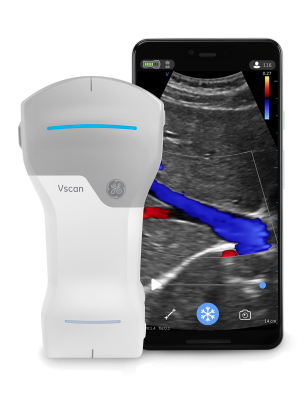 GE医疗公布了Vscan Air的重大数字更新，这是其前沿的无线手持袖珍超声设备，提供透明的图像质量、全身扫描功能和直观的软件——所有这些都在临床医生的手中。