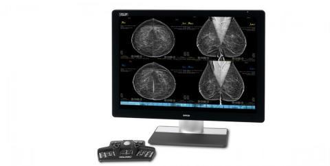 合作将包括数据共享、研发和将RadNet的乳房x光检查系统升级到Hologic最先进的成像技术