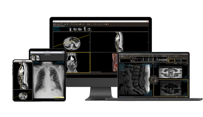 Rome Radiology Group (RRG), based in Rome, Ga., became the first member of the national Strategic Radiology (SR) coalition of independent private radiology practices to opt into the SR Enterprise PACS license for IntelePACS and Clario SmartWorklist from Intelerad Medical Systems, a global leader in medical image management solutions.