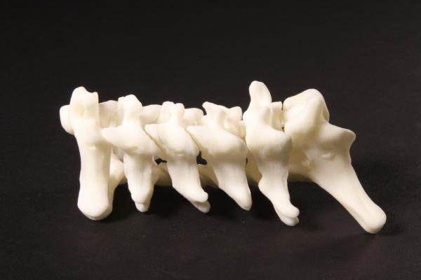 Materialise公司首家获得FDA批准的诊断3d打印解剖模型