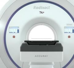 Accuray公司为Radixact系统推出同步运动跟踪与校正技术