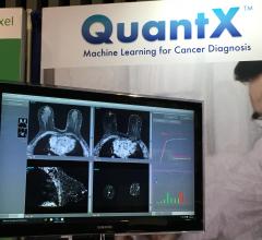 人工智能可以产生更准确的乳腺癌诊断