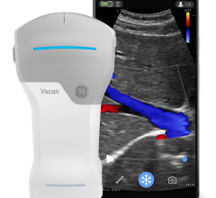 GE Healthcare unveiled a major digital update for Vscan Air, its cutting-edge, wireless handheld pocket-sized ultrasound device that provides crystal clear image quality, whole-body scanning capabilities, and intuitive software - all in the palm of clinicians’ hands. 