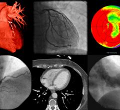 发表在《放射学:心胸成像》(Radiology: cardithoracic Imaging)上的一项关于心脏成像十年趋势的新研究报告称，从2010年到2019年，医院门诊放射科医生进行冠状动脉ct血管造影(cCTA)检查的比率显著增加，这表明该技术有一个光明的未来。