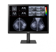 # LG业务解决方案美国宣布最新的LG的全面专业、医用诊断# #显示器,31英寸,拥有# 31 hn713d,可用于多种模式#诊断研究中,包括3 d #乳房x光检查。