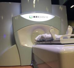 MRIdian系统限制了没有植入标记的前列腺癌早期毒性