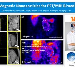 纳米磁性粒子作为PET/MRI双峰显像剂的研究