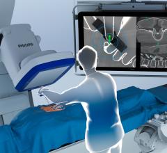 在这两种情况下，外科医生都使用了飞利浦集成的Spine Suite解决方案，该解决方案为该公司的Azurion混合手术室(OR)提供了ClarifEye，这是业界首创的解决方案，将低x射线剂量下的2D和3D可视化与3D AR导航结合到一个系统中。