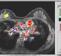 Paragon Biosciences推出高质量成像技术，以推进fda批准的AI乳腺癌诊断系统