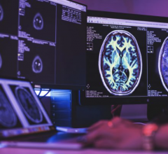 synticmr和Siemens Healthineers于2016年签署了合作协议，自2018年起，SyMRI neuroo已经可以在Siemens Healthineers数字市场上购买。该产品可以无缝集成到临床工作流程中。