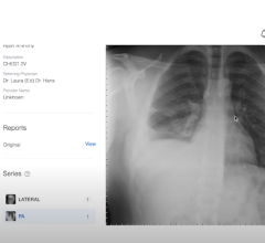 以患者为中心的医疗图像共享平台PocketHealth宣布推出Report Reader。