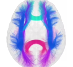 Imeka是一家结合弥散成像和AI来绘制白质完整性的领先神经成像公司，今天宣布与GE Healthcare合作，扩大磁共振成像(MRI)的能力，推进大脑健康的精准医疗。