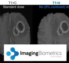 专利人工智能技术消除了MRI检查中基于钆的造影剂的需要