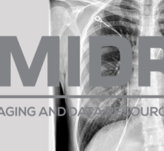 经过不到两年的数据收集和处理，北美放射学会(RSNA)已经成功地向医学成像和数据资源中心(MIDRC)交付了3万多份去识别成像检查，MIDRC是一个开放获取平台，发布用于研究的数据。