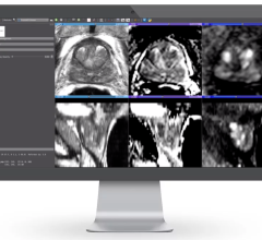 总部位于奥马哈的MRI医疗设备公司Bot Image开发了一款人工智能驱动的医疗设备CAD软件，可以显著提高前列腺癌检测(CADe)和诊断(CADx)的准确性和速度。