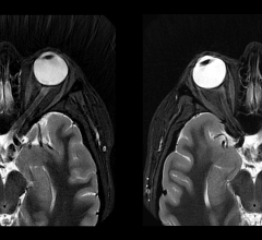 将基于深度学习的AIR Recon DL兼容性扩展到3D和PROPELLER，有可能在MRI中实现更自信的患者诊断