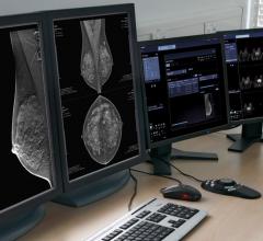 西门子Healthineers Syngo。乳房护理增加基于人工智能的决策支持