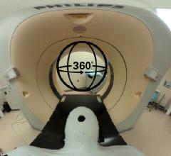 亨利·福特医院（Henry Ford Hospital Philips）CT扫描仪用于放射治疗的CT模拟治疗​​计划。